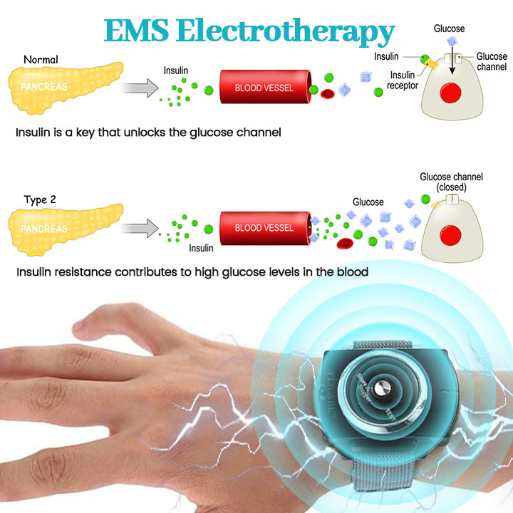 FLYCARE™ GylcoNova Electric Pulse Device