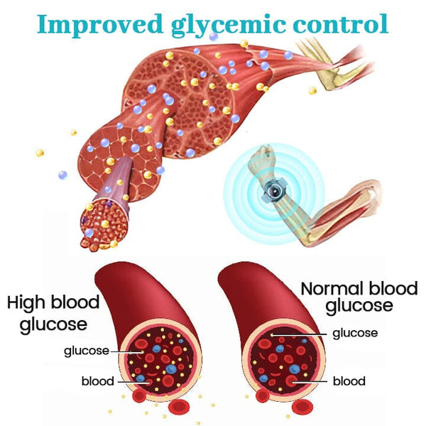 FLYCARE™ GylcoNova Electric Pulse Device