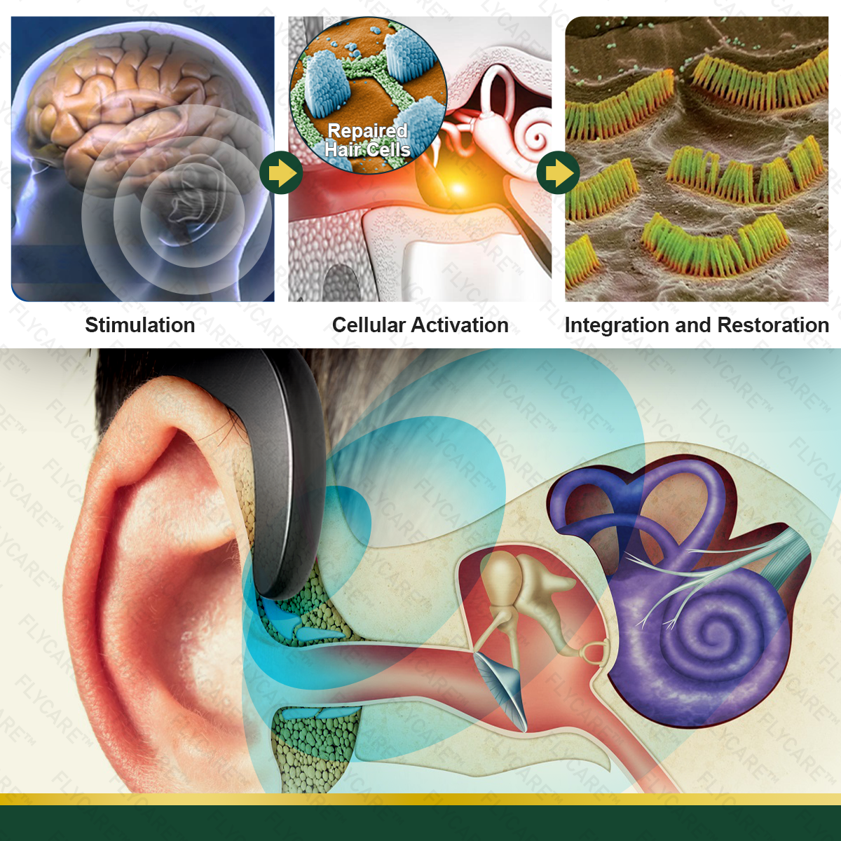 FLYCARE™ AudioCalm Tinnitus Magnetic Therapy Device⭐