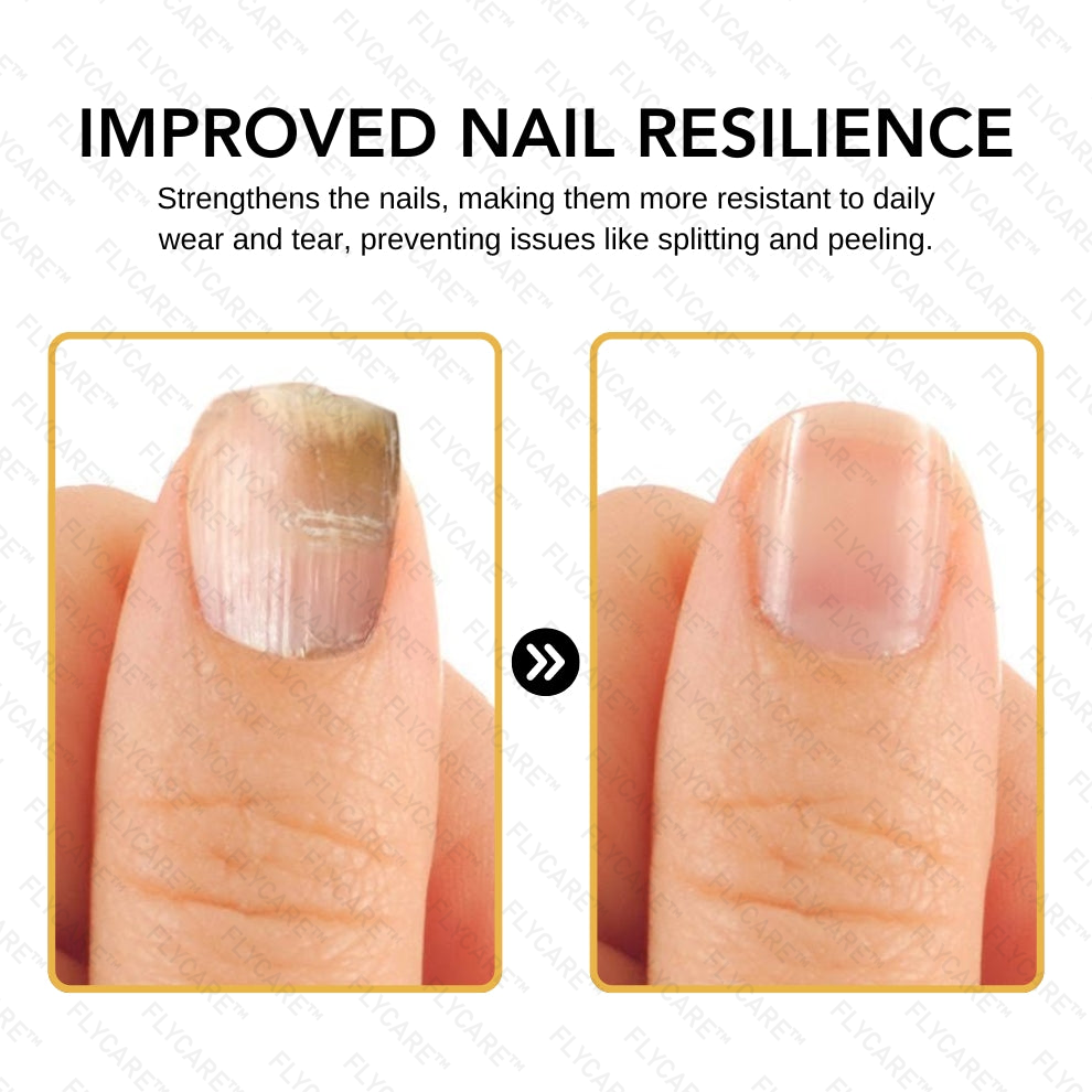 FLYCARE™ BeeVenom Nail Fungus Solution