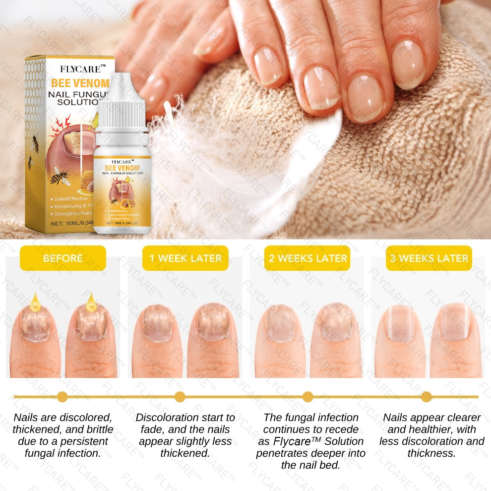 FLYCARE™ BeeVenom Nail Fungus Solution